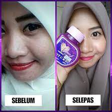 +60113 • 253 • 8434 facebook. Testimoni Dianz Vitamin