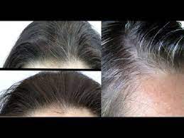 Coconut Oil And Lemon Mixture It Turns Gray Hair Back To Its Natural Color Youtube Coconut Oil Hair Coconut Oil Hair Mask Natural Gray Hair