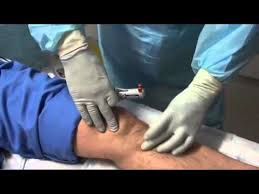 Check spelling or type a new query. Parenteral Access For Fluid Administration In Patients With Ebola Virus Disease Youtube