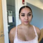 'It's Inevitable' Monkeypox Cases Likely To Rise In CT