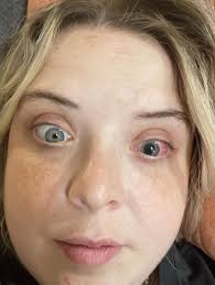 THE FINALLY OPENING UP SERIES