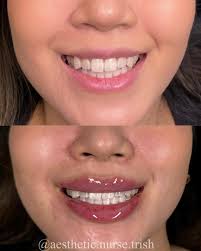 Trisha Skinner, RN, BSN