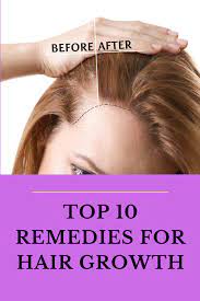 Top 10 Remedies For Hair Growth Hair Fall Solution Hair Growth Hair