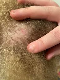 Image result for sores on the head in children