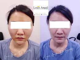 Louis Angel De Beauty (@louisangeldebeauty) • Facebook