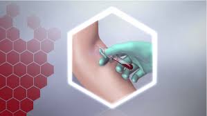 In most cases, blood tests alone cannot detect cancer. Complicated Scientific Tests Simply Explained Cast Pharma