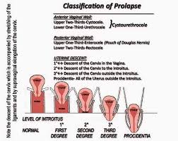 Maybe you would like to learn more about one of these? Tanda Tanda Peranakan Jatuh Peringkat Awal