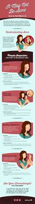 Is itchy skin crashing your precious sleep? It May Not Be Acne