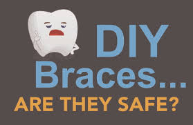 How to make fake braces. Are Do It Yourself Diy Braces Safe Premier Orthodontics