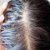 Using dry shampoo soaks up some of the oil with a powdery substance that brushes easily from hair leaving hair smell good and look clean without the use of water or shampoo. Https Encrypted Tbn0 Gstatic Com Images Q Tbn And9gcsjkmgk6punjwtqimvhtoxh0us 0dtcyxnyjhvhzglggu5dbzhx Usqp Cau