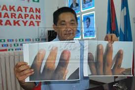 Baca cara menghilangkan iklan di xiaomi ini, dijamin iklan hilang selamanya! Pkr Dakwa Dakwat Kekal Mudah Hilang Spr Perjelas Puncanya Jadi Sedemikian