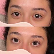 Fuzz free Friday 🍑 #dermaplanefacial