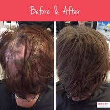 They might not even know that they're losing their hair as a result of menopause. Pin On Boost N Blend Before And Afters