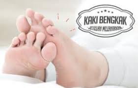 Jantung bengkak yang diakibatkan oleh adanya penebalan yang terdapat pada otot jantung atau yang biasa disebut dengan hipertrofi. Cara Mengatasi Bengkak Susu Cara Mengatasi Gusi Bengkak Dengan Baik Secara Alami Dan Benar 11 Cara Mengobati Bibir Bengkak Yang Jarang Dilakukan Jamua Ya