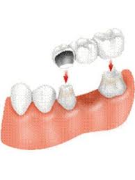 Bds (malaya) mclindent prosthodontics (london) ficcde (prosthodontics). Dentists In Shah Alam Malaysia Check Prices Reviews