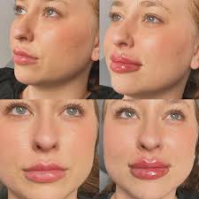 Brightside Aesthetics