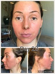 WHEN I DON'T LOOK LIKE WHAT I'VE BEEN THROUGH, WITH THE HELP OF YARN,  CONTACTS, & MAKE-UP 😂😂😂 SERIOUSLY THOUGH THANK YOU.💖 MrsAlice Morgan  FOR THE PRAYERS AND ENCOURAGEMENT, THIS PROFILE PIC