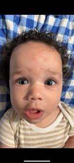 Gerber baby contest nomination