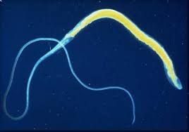 Image result for Whipworm