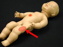 8 05 Administration Of Vitamin K Obstetric And Newborn Care Ii