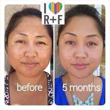 Cindy Barker . Skinsational Living