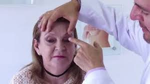 BLEFAROPLASTIA DR FABIÁN CUEVAS