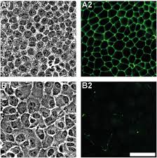 This communication happens through proteins known as communicating junction. Importance Of Integrity Of Cell Cell Junctions For The Mechanics Of Confluent Mdck Ii Cells Scientific Reports