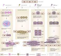 The rarity of this tumor and its strong association with asbestos exposure make it a &#x27;signal tumor,&#x27; Mesothelial To Mesenchyme Transition As A Major Developmental And Pathological Player In Trunk Organs And Their Cavities Communications Biology