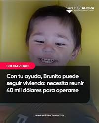 🫂 Con tu ayuda, Brunito puede seguir viviendo: necesita reunir 40 mil  dólares para operarse Nació con una cardiopatía congénita. Familiares han  abierto un colectivo para quienes puedan colaborar. La nota completa