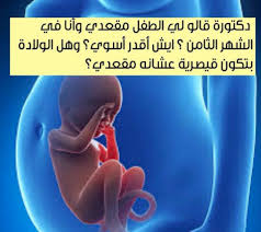 ولادة الجنين المقعدي طريقه لف الجنين المقعدي الحامل الحمل والولادة In 2020 Convenience Store Products Convenience Store