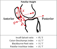 Image result for Patella Tracking Assessment