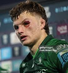 43 Irish Michael Prendergast Photos & High Res Pictures