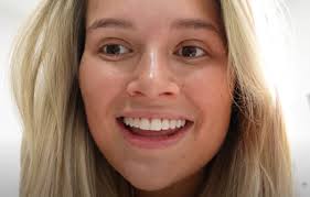 Molly-Mae Hague reveals teeth transformation