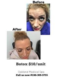 When the light beam hits the hair follicle (where hair growth originates), the intense heat destroys. Oakland Medical Spa Home Facebook