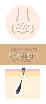 25 amazing home remes for blackheads