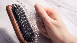 Haarausfall Die Arten Ursachen Und Mittel