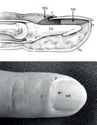 Image result for paronychium