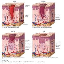 Image result for Wound Repair