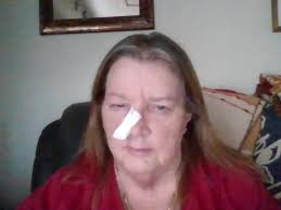 Petition · Protect Medicare and Private Insurance Coverage for Nonsurgical  Skin Cancer Treatment