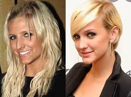 Ashlee Simpson Plastic Surgery Are All The Rumors True