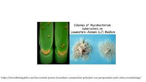 The lowenstein jensen medium, popularly known as lj medium, is a growth medium specially used for culture of mycobacterium, notably mycobacterium tuberculosis. Mycobacteria Medical Bacteriology By Dr Alhhazmi Mycobacteria Mycobacteria