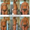 Although depo plays around with your hormones a lot.i lost my hair with my first shot and gain 60lbs in a month and half.so i hate depo. Https Encrypted Tbn0 Gstatic Com Images Q Tbn And9gcqqemesjvgdkrjglpz Rix5ytgrzrn1srbunziookmk5mktszsp Usqp Cau