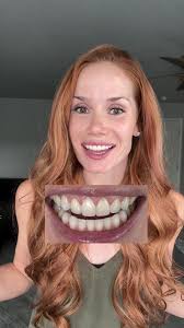 The easiest whitening treatment I've ever done. The snow purple whiten...