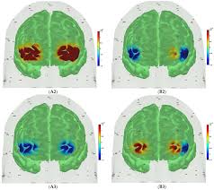 Operational Modal Analysis of Near-Infrared Spectroscopy Measure of 2-Month  Exercise Intervention Effects in Sedentary Older Adults with Diabetes and  Cognitive Impairment