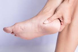 Your Summer Guide To Preventing Athlete S Foot Go Feet Podiatrists
