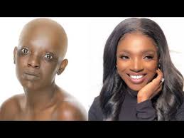 Jun 25, 2021 · by gbenga bada. 2baba Annie Idibia S Daughter Undergoes Surgery Qed Ng