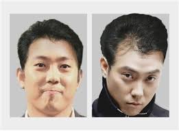 Tvn 관계자는 13일 스타뉴스에 하준수, 안가연이 제작진과 논의 끝에 금일 녹화에 참여하기로 했다. ì€ì§€ì› íƒˆëª¨ìœ„í—˜ ì§„ë‹¨ ì›ì¡° ì•„ì´ëŒì´ ëŒ€ë¨¸ë¦¬ê°€ ë  ìˆ˜ ìžˆë‹¤ ì¶©ê²© Sbsì—°ì˜ˆë‰´ìŠ¤