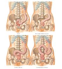 Sigmoid Colon Variations In Position Anatomy Typical Short Straight Obliquely Into Pelvis Looping To Right Side Ascending H Sigmoid Colon Colon Anatomy