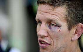 Dirk van tichelt (born 10 june 1984) is a belgian judoka. Bronzen Dirk Van Tichelt Loopt Blauw Oog Op In Rio Wilde Verhalen Compleet Uit De Lucht Gegrepen Andere Sporten Sportmagazine