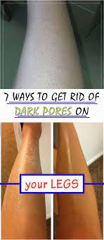 7 Ways To Get Rid Of Dark Pores On Your Legs Homemade Beauty Ingrown Hair Ingrown Hair Remedies Shaving Tips